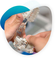 Implant Dentaire