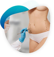 Liposuccion