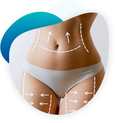 Liposuccion